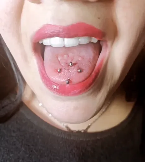 Perforacion en la lengua Surface en Diamante